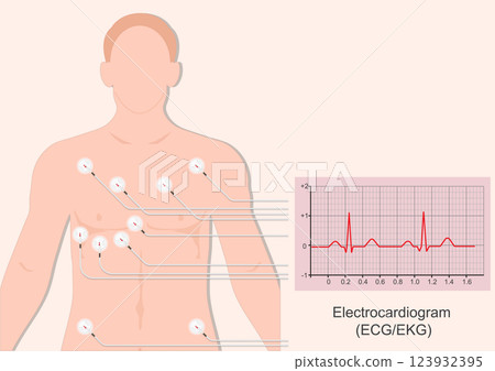 An electrocardiogram . An electrocardiogram . 123932395