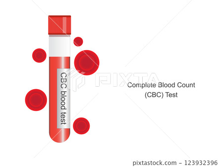 Complete blood count CBC is a blood test. 123932396