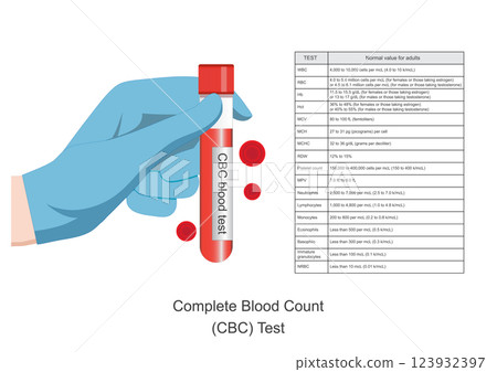 Complete blood count is blood tests. 123932397