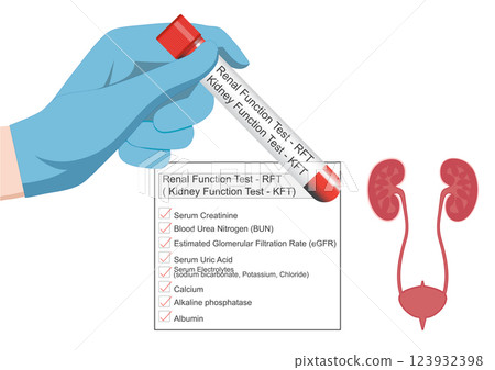 Kidney function tests (renal function tests) 123932398