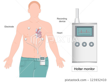 A Holter monitor heart monitor  123932410