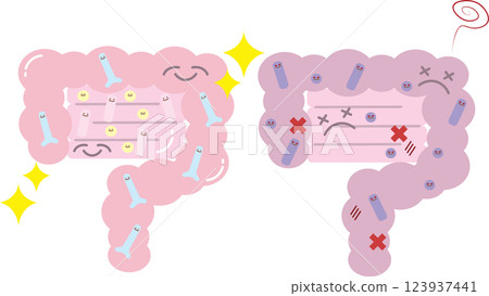 A comparison illustration of a healthy, clean intestine with many good bacteria and an unhealthy intestine with many bad bacteria 123937441