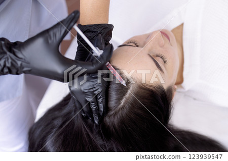 plasmolifting or PRP method point the introduction of the patient's own plasma 123939547
