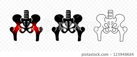 Pelvic bones or hip bone, hip inflammation in circle, orthopedic, graphic design. Healthcare, medicine, rheumatology and traumatology, vector design and illustration Pelvic bones or hip bone, hip inflammation in circle, orthopedic, graphic design. Healthcare, medicine, rheumatology and traumatology, vector design and illustration 123948684
