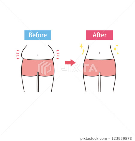 Before and after of a bulging belly 123959878