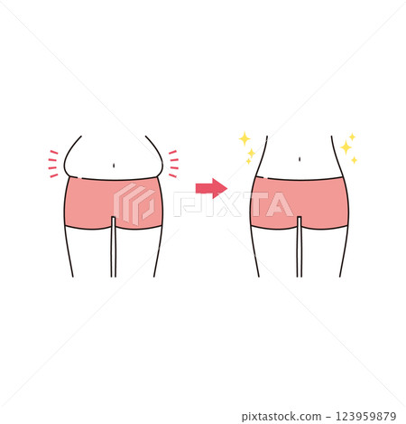 Before and after of a bulging belly 123959879