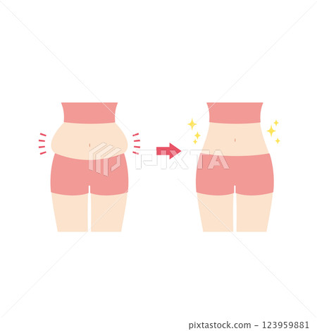 腹部隆起前後 123959881