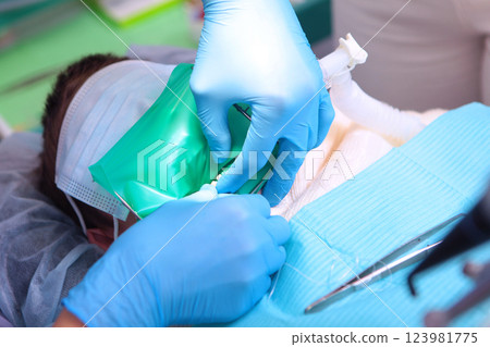 Treatment of baby teeth. Child is under anesthesia during dental treatment. Photo during the operation. Treatment of baby teeth. Child is under anesthesia during dental treatment. Photo during the operation. 123981775