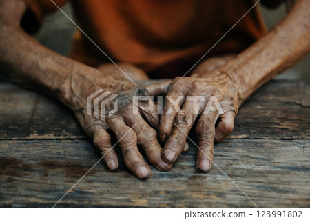 Close up of male wrinkled hands, old man is wearing  skin disease and anxiety Copy space. 123991802
