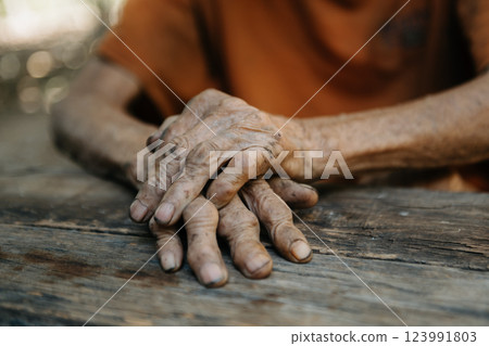 Close up of male wrinkled hands, old man is wearing  skin disease and anxiety Copy space. 123991803