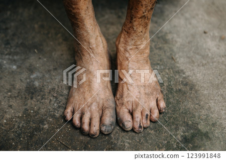 Close up of male wrinkled hands, old man is wearing skin disease and anxiety Copy space. Close up of male wrinkled hands, old man is wearing skin disease and anxiety Copy space. 123991848