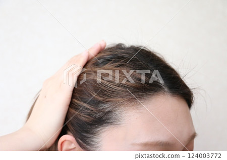A woman who is concerned about thinning hair on her forehead A woman who is concerned about thinning hair on her forehead 124003772