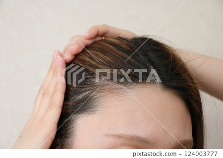 Women who are concerned about thinning hair at the hairline Women who are concerned about thinning hair at the hairline 124003777