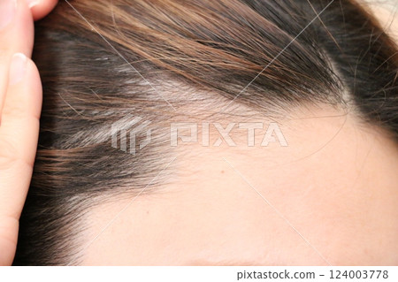 Women who are concerned about thinning hair 124003778