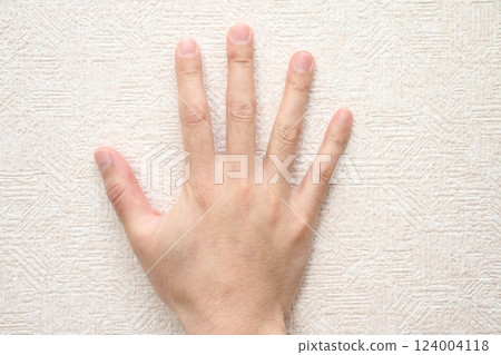 Hypertrichosis of the back of the hand and fingers 124004118