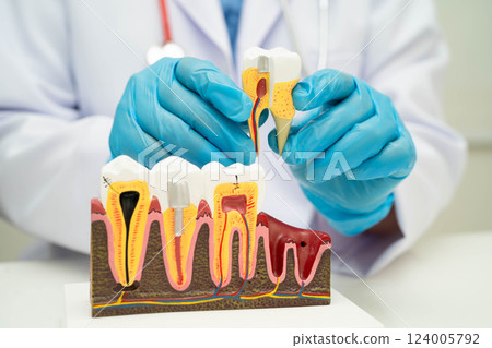 Dentist holding dental implant, artificial tooth roots into jaw, root canal of dental treatment, gum disease, teeth model for dentist. 124005792