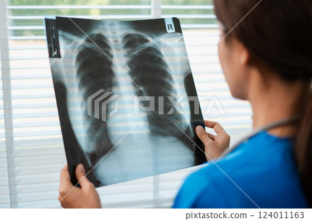 A healthcare worker examines a chest X-ray, focusing on the details for accurate diagnosis in a clinical setting. 124011163