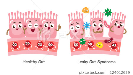 Leaky gut syndrome and healthy gut . Cute medical cartoon character . Vector . 124012629