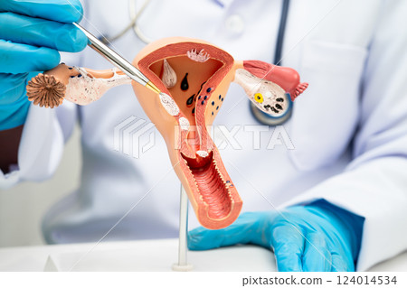 Uterus, doctor holding human anatomy model for study diagnosis and treatment in hospital. 124014534