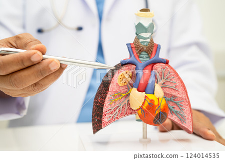 Pneumonia, lung cancer, Asian doctor holding human anatomy model for study diagnosis and treatment in hospital. Pneumonia, lung cancer, Asian doctor holding human anatomy model for study diagnosis and treatment in hospital. 124014535