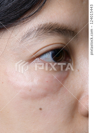 Close up of Asian woman eye with visible under eye swelling and skin texture Close up of Asian woman eye with visible under eye swelling and skin texture 124015443