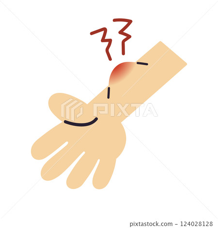 紅腫的手臂、昆蟲叮咬、瘀傷/向量手繪插圖 紅腫的手臂、昆蟲叮咬、瘀傷/向量手繪插圖 124028128