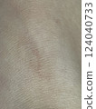 Skin, close-up, wound, healing 124040733