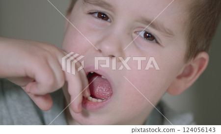 Child Opens His Mouth To Show Wiggling Baby Tooth. Child Showing His Milk Tooth Before Losing It. Permanent Tooth Replacement. 124056143