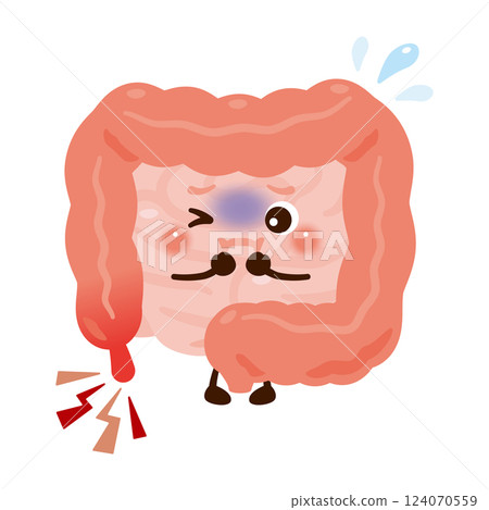Character illustration of an intestine with appendicitis 124070559
