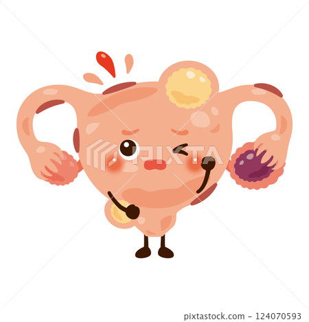 子宮內膜異位症和子宮肌瘤的子宮特徵說明 124070593