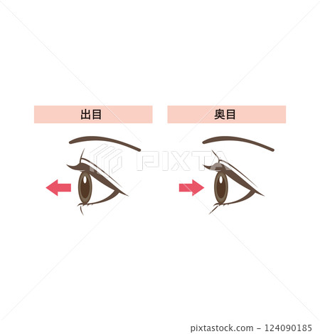 凸眼和深陷眼的區別圖解 凸眼和深陷眼的區別圖解 124090185