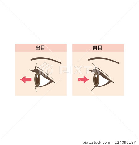 凸眼和深陷眼的區別圖解 凸眼和深陷眼的區別圖解 124090187
