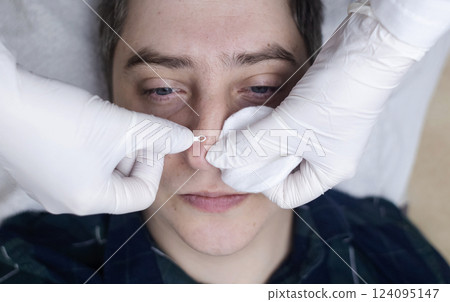 Man undergoing facial cleansing and blackhead removal. Beautician using comedone extractor or uno loop. Professional skin care in a beauty salon Man undergoing facial cleansing and blackhead removal. Beautician using comedone extractor or uno loop. Professional skin care in a beauty salon 124095147