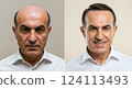 Mature middle-eastern male transformation with hair and smile in split before and after 124113493