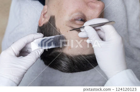 A dermatologist uses tweezers to take a scraping of a male patient's eyebrows for a demodex test. Dermatological examination and diagnosis of skin parasites and mites. 124120123