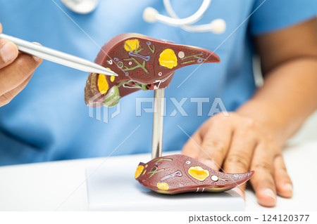 Cirrhosis, Liver cancer, fatty liver, Asian doctor with liver human anatomy model in World Hepatitis Day at hospital. 124120377