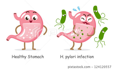 Healthy stomach and Helicobacter pylori infected stomach . Cute medical cartoon characters . White isolated background . Vector . 124120557