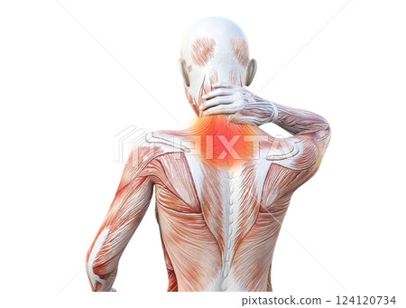 一名女性因頸部僵硬而握住頸部的肌肉解剖圖、上身、後視圖（紅色疼痛圖像）的 3D 插圖 124120734