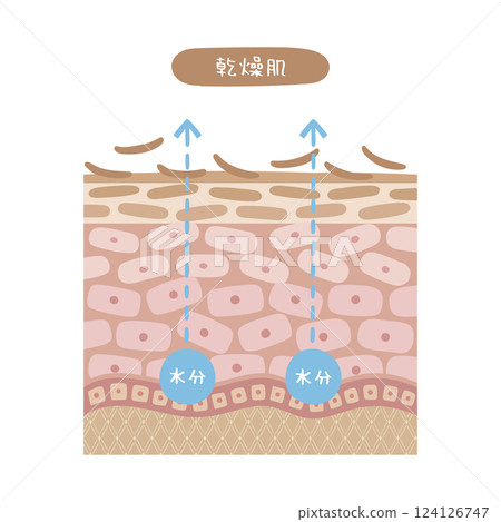 乾性皮膚橫斷面圖示 乾性皮膚橫斷面圖示 124126747