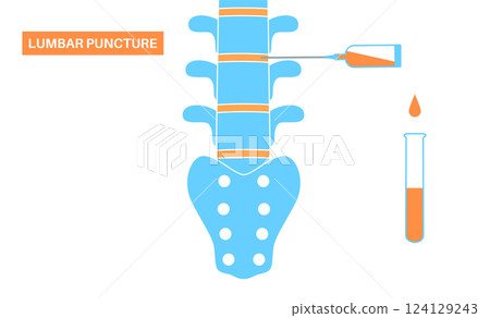 Lumbar puncture spinal tap 124129243