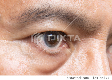 Senior man eye strain after for long stretches at computer or digital screens. 124144177