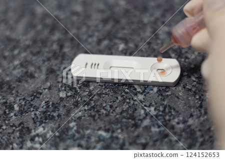 The laboratory assistant drips a blood sample for an express test cashier for the diagnosis of viral diseases. Express analysis of viral diseases on the table in the laboratory. The laboratory assistant drips a blood sample for an express test cashier for the diagnosis of viral diseases. Express analysis of viral diseases on the table in the laboratory. 124152653
