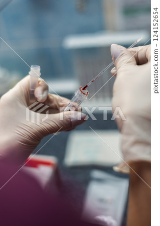 The close plan of the laboratory assistant in gloves performing a blood test, moving a sample into a test tube using a pipette in the laboratory. The laboratory assistant conducts a blood test. The close plan of the laboratory assistant in gloves performing a blood test, moving a sample into a test tube using a pipette in the laboratory. The laboratory assistant conducts a blood test. 124152654