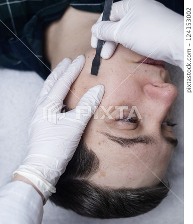 A dermatologist takes a skin scraping and tests for demodicosis and dermatitis, fungal infection. Close-up of a male patient's face at a doctor's appointment 124153002