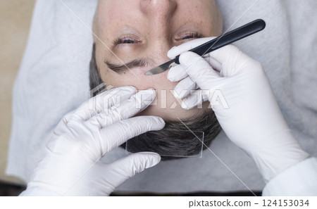 A dermatologist takes a skin scraping and tests for demodicosis and dermatitis, fungal infection. Close-up of a male patient's face at a doctor's appointment A dermatologist takes a skin scraping and tests for demodicosis and dermatitis, fungal infection. Close-up of a male patient's face at a doctor's appointment 124153034