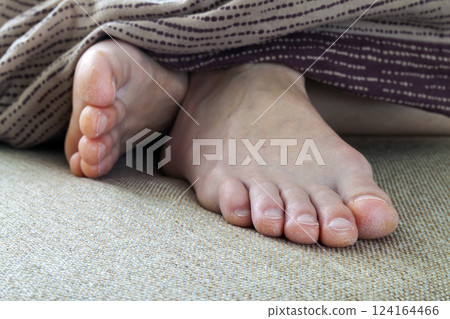 Dry cracked skin of woman feet in bed. Foot treatment. 124164466