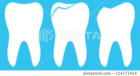 Illustration of Healthy, Chipped, and Fractured Teeth on Blue Background 124171428