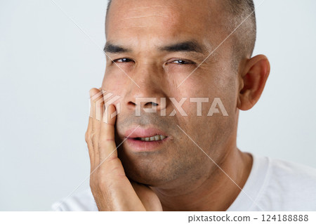 The man has facial swelling due to an allergic reaction to triggers such as insect bites stings. 124188888