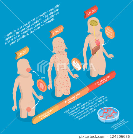 3D Isometric Flat Vector Illustration of Syphilis, STD, Sexual Transmitted Diseases 3D Isometric Flat Vector Illustration of Syphilis, STD, Sexual Transmitted Diseases 124206686