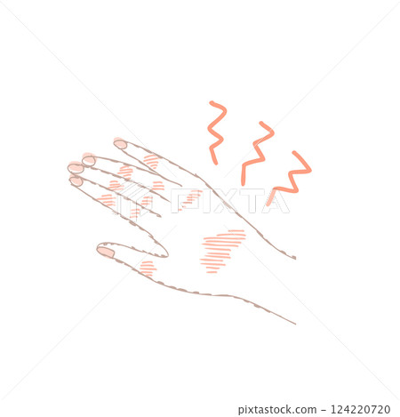 手部護理 手部問題 124220720